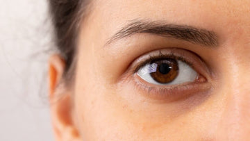 Dile adiós a las ojeras con estos 2 activos